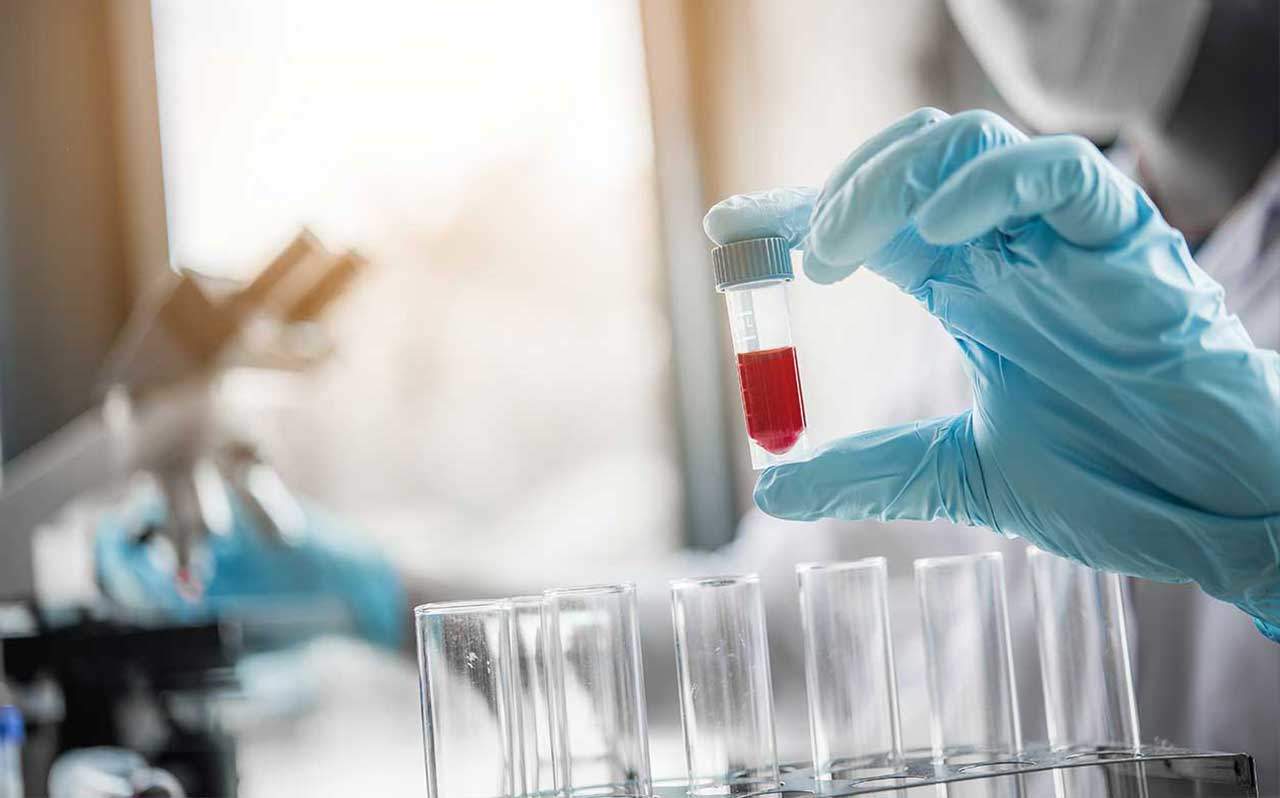 Blood and Urine samples being tested